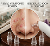PoriePomp™ – Elektrische Poriënreiniger & Acne Verwijderaar